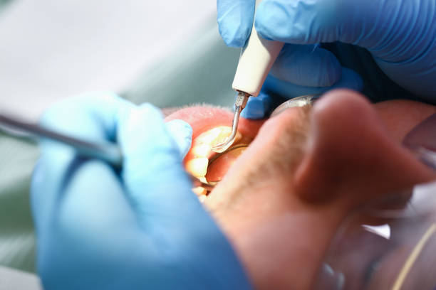 Best Emergency Tooth Extraction in Mount Hope, NJ