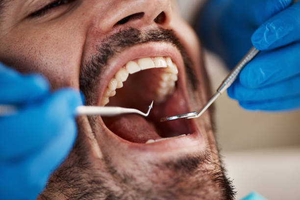 Best Emergency Treatment for Toothache in Mount Hope, NJ