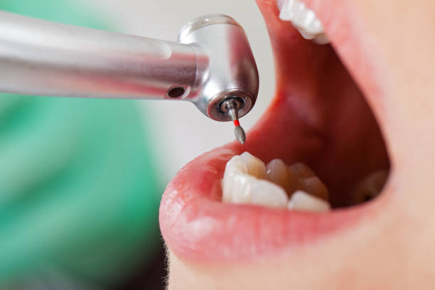 Best Emergency Tooth Extraction in Mount Hope, NJ